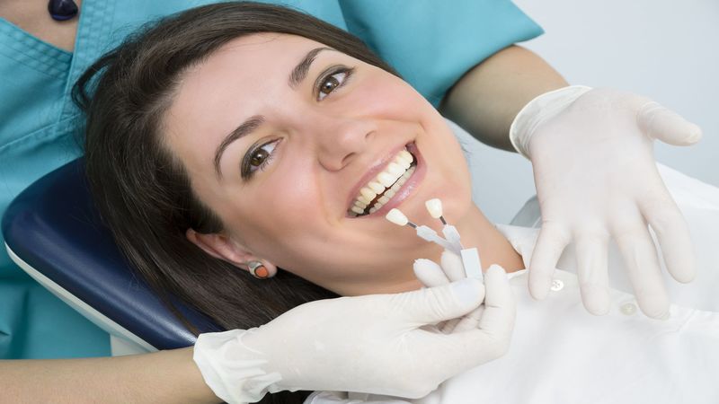 3 Facts That You Should Know About Dental Veneers