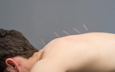 Using an Acupuncture Master’s Degree to Advance Your Profession